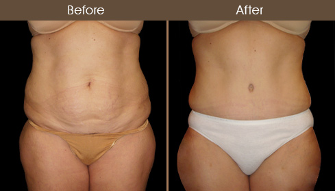 20202805180038_107-front